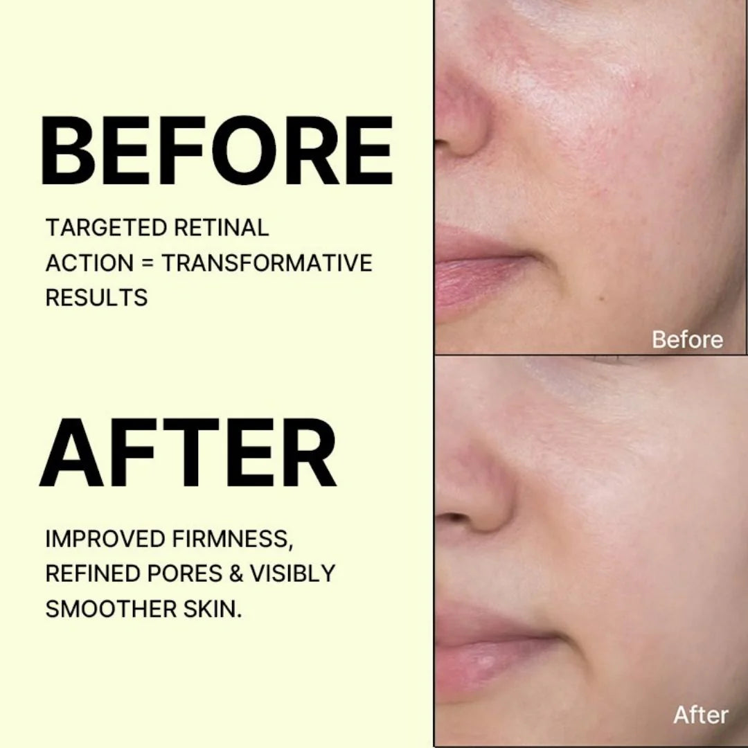 Serum Retinal 0.1% Celimax – Tinh Chất Hỗ Trợ Se Khít Lỗ Chân Lông & Làm Mịn Da (15ml) - VT Glamour