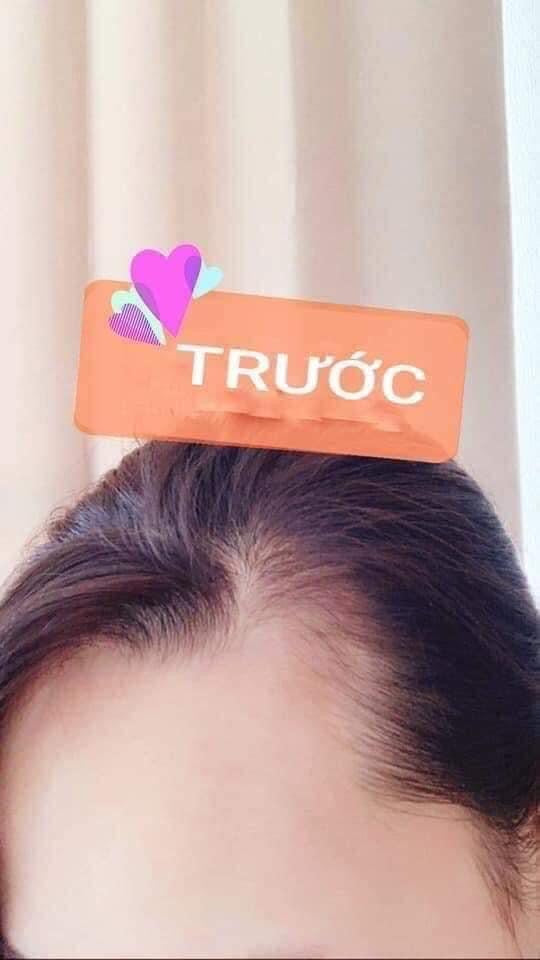 Sato Arovics Solution 5% for Hair - VT Glamour