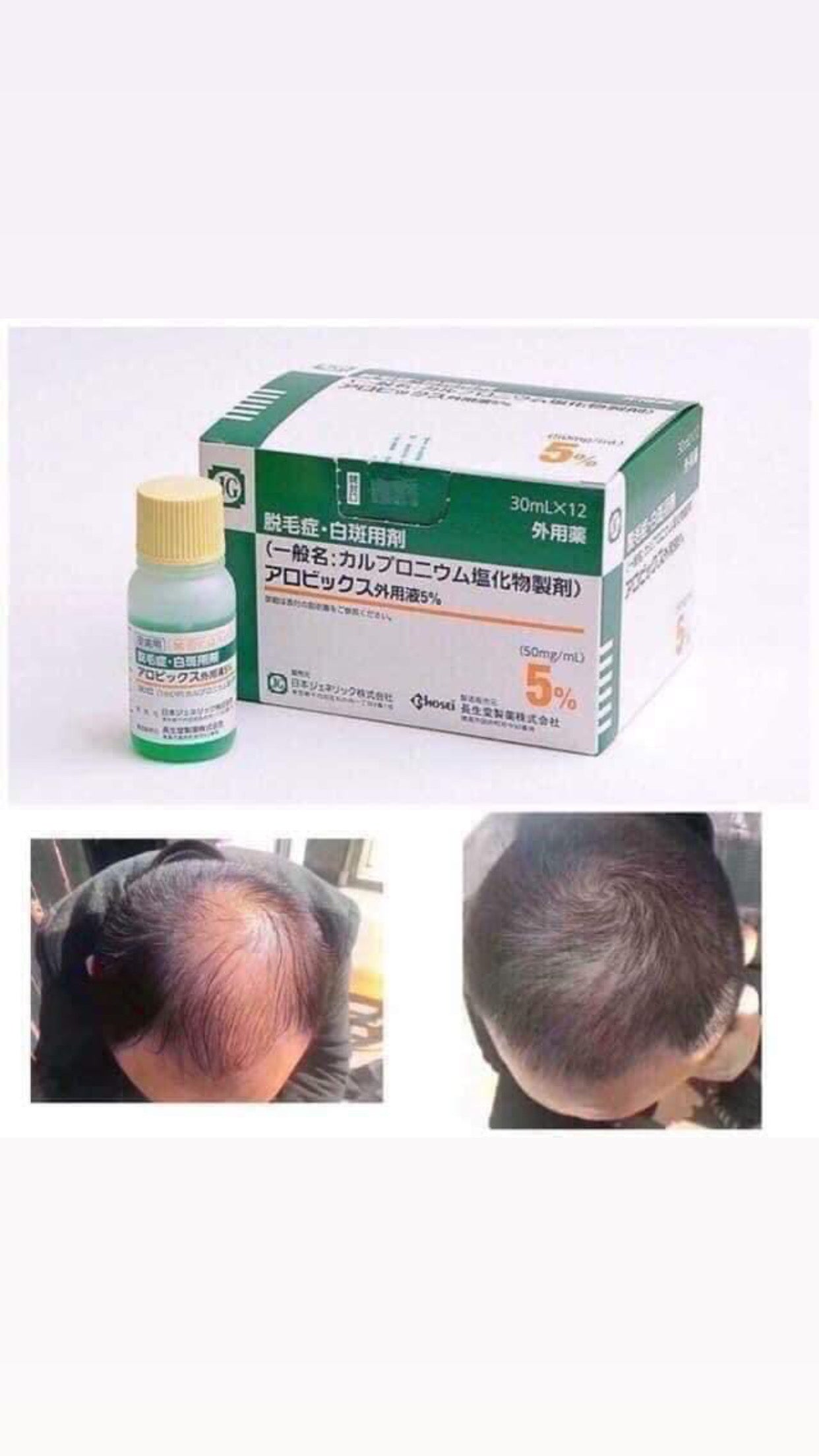 Dung Dịch Dưỡng Da Đầu Sato Arovics Solution 5% – 30ml x 12 Chai - VT Glamour