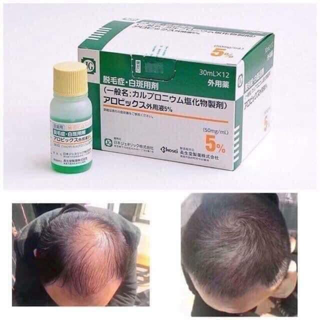 Sato Arovics Solution 5% for Hair - VT Glamour