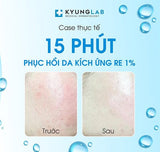 KyungLab Bio Hyaluronic Face Mask