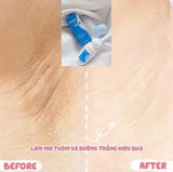 Lăn Nách Skincheers Fresh