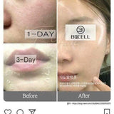 BQCell Derma Skin Peeling & Recell cure Ampoule Set