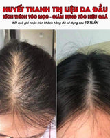 Serum Dưỡng Tóc WEILAYA - Vt Glamour