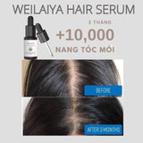 Serum Dưỡng Tóc WEILAYA - Vt Glamour