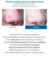 Máy Rửa Mặt Làm Sạch Sâu, Kết Hợp Chức Năng Massage WellDerma Cleansing Fish